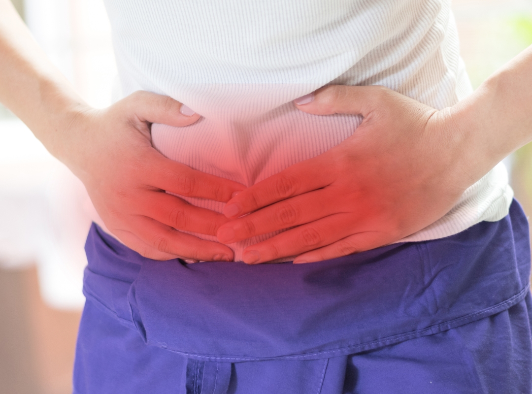 Hérnia Inguinal: O Que Causa e Como Tratar Antes que Se Torne Grave