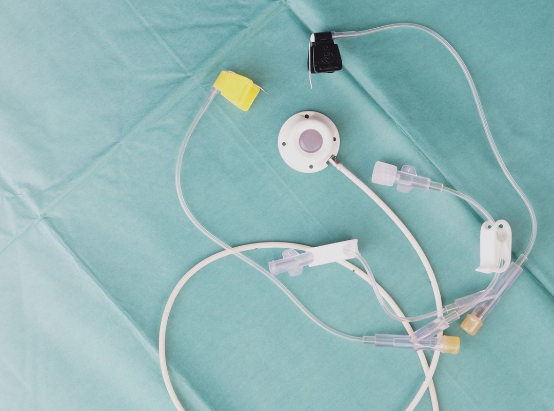 Portocath em Oncologia: Como Ele Facilita a Vida dos Pacientes?