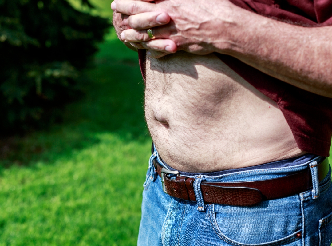 Hérnias Recorrentes: Por Que Elas Voltam e Como Tratar de Forma Definitiva