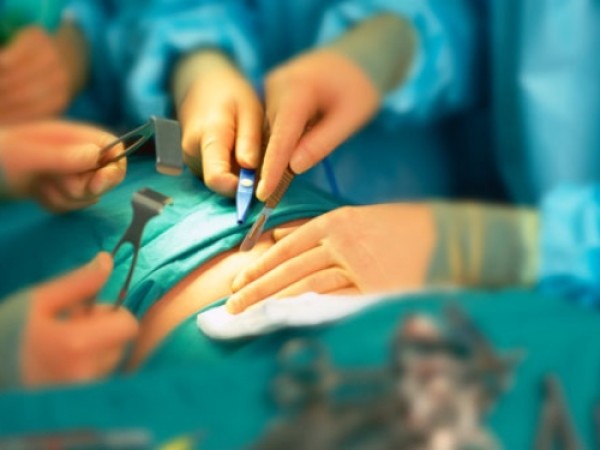 Imagem do procedimento Cirurgia Oncológica (tratamento de neoplasias/tumores) do aparelho digestivo